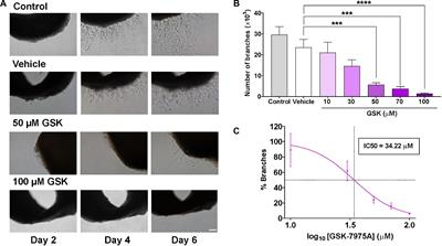 SARAF and Orai1 Contribute to Endothelial Cell Activation and Angiogenesis